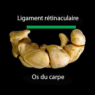 schéma simplifié du tunnel carpien