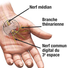 Schema des nerfs de la main